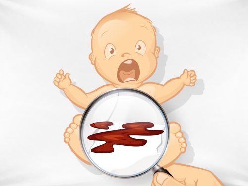 Blut im Stuhl